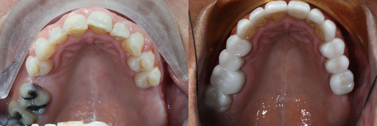 Occlusal_Klaich.jpg