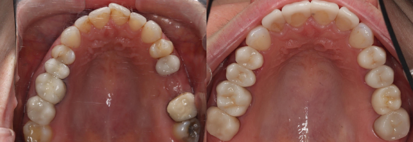 Occlusal_Sahasrabudhe.jpg